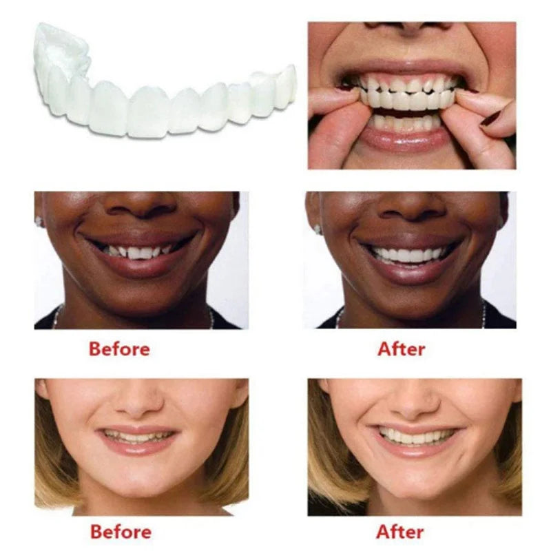 Transforme Seu Sorriso em Minutos Aparelho de Dentes Instantâneo: Sua Solução Acessível para um Sorriso Perfeito - Uso Temporário